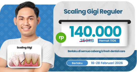 Scaling Gigi Regular